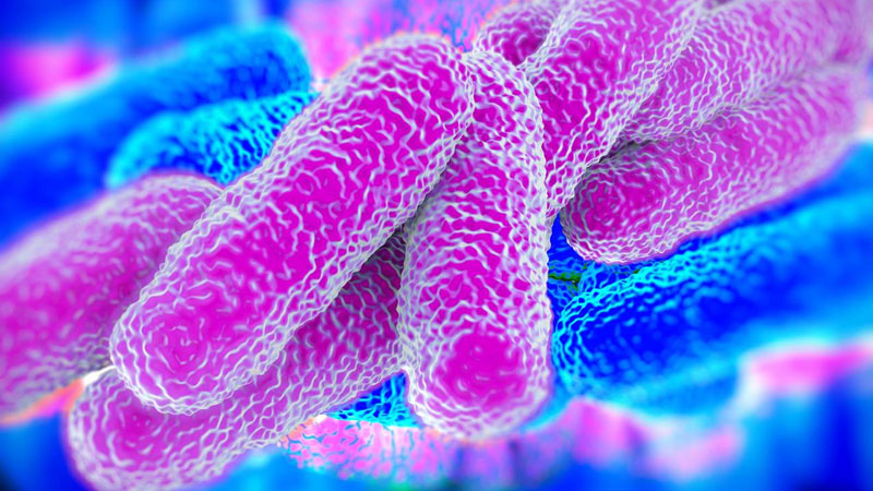 Problema legionella